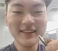 Rear To Ear: Dude Eats AirPod, Poops It Out And It Still Works