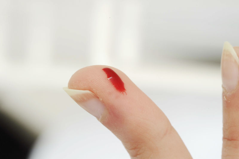 Extreme closeup of finger pricked with blood.
