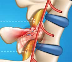 Intel And Brown University Deploy AI To Help Paralyzed Patients Regain Movement