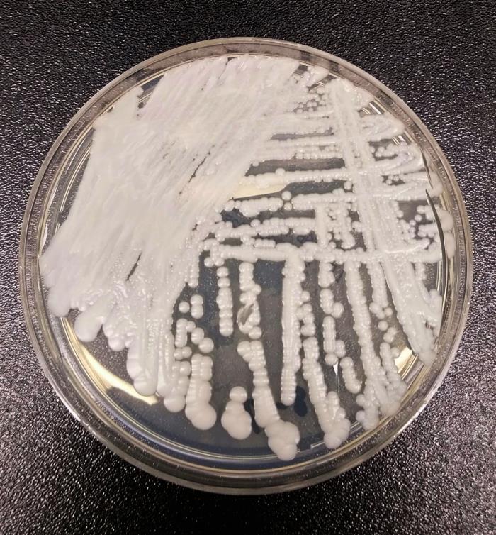 A strain of <em>Candida auris</em> cultured in a petri dish at the CDC.