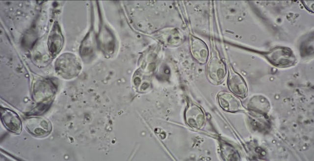 multicellular-organism-with-no-respiration.jpg