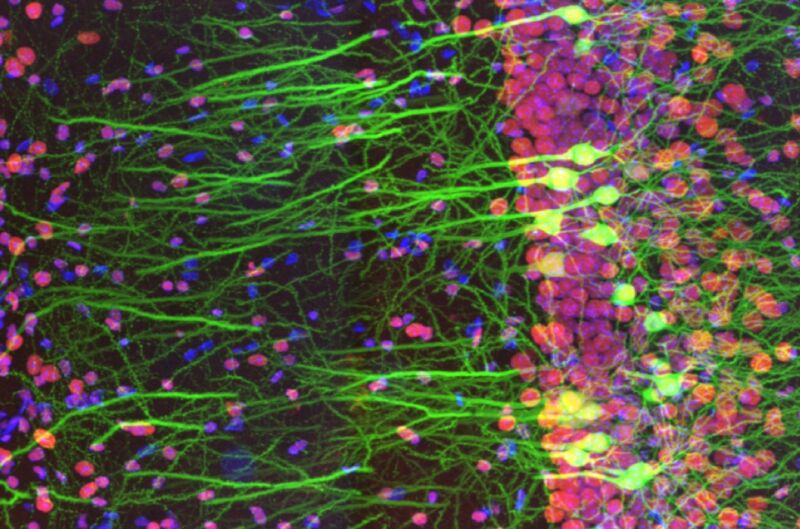 Detail from the winning entry in the first Olympus Global Image of the Year Life Science Light Microscopy Award. It shows immunostaining of a mouse brain slice with two fluorophores.