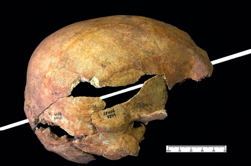 Reconstruction of the angle of entry into a cranium collected during the excavation of the burial ground of a medieval Dominican friary in Exeter, England.