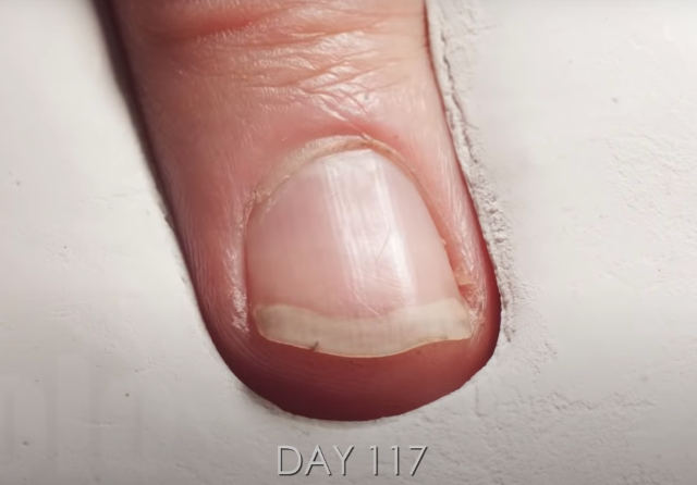 fingernail-timelapse.jpg