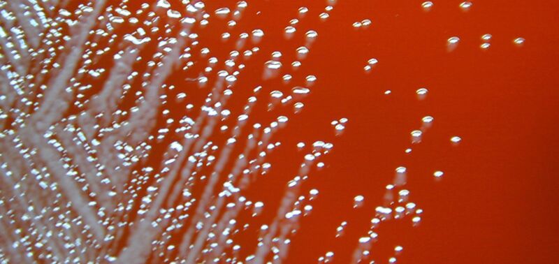 Extreme close-up photograph of white flecks growing in red blood.
