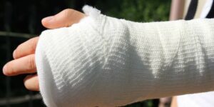 Injury Orthopedics Chalk Bandage Treatment