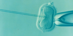 Ivf Fertility Infertility Microfertilization Ovum