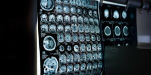 medical image analysis