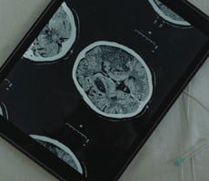 Intel And UPenn Pioneer Machine Learning That Dramatically Improves Brain Tumor Detection