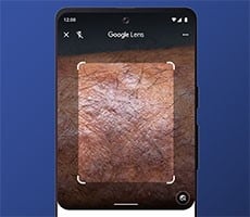 Forget WebMD, Google Lens Can Identify Your Rash, Mole And Other Skin Conditions