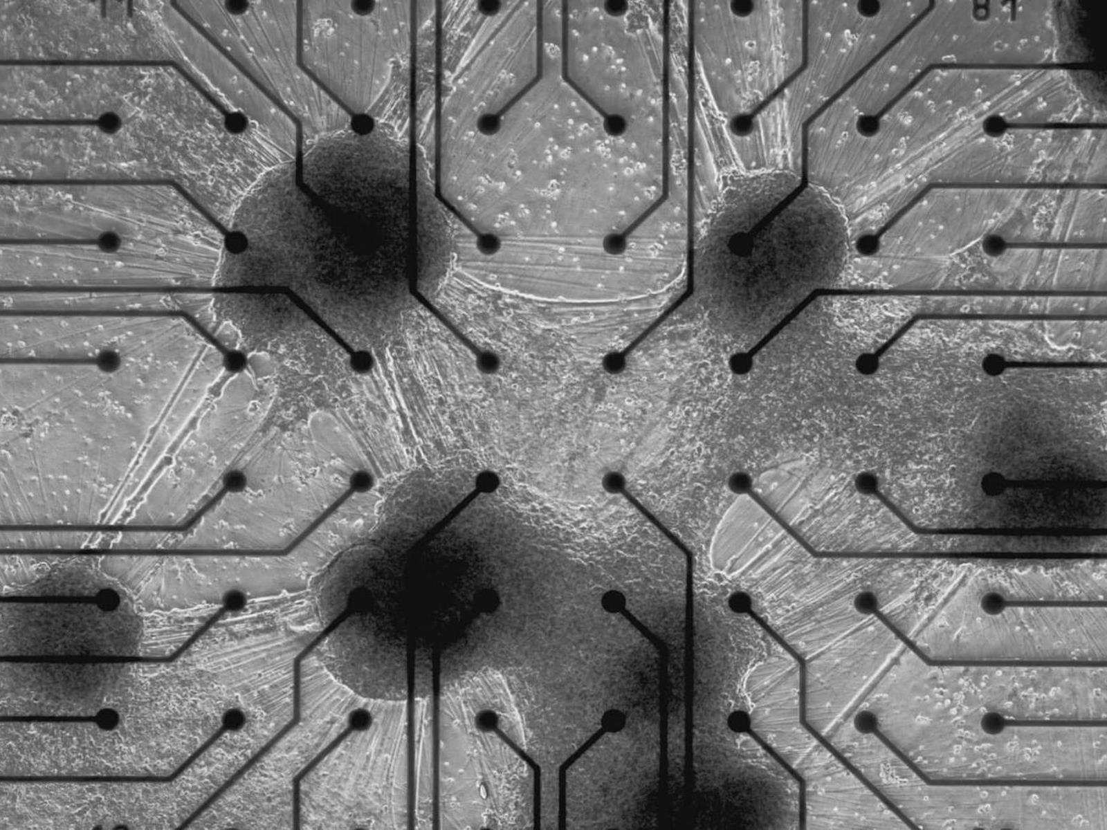 The World's First AI Computer Running On Human Brain Cells Has Been Born